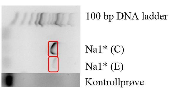 Gelelektroforese av Multiplex PCR-produkt av DNA-templat fra koloni med ESBL-fenotypisk resistens: Figur C.