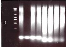som vist i figur 20. Denne figuren viser et elektroforesebilde av PCR-produktet av de ulike restriksjonskuttede og ligerte prøvene.