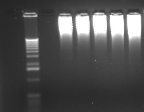 Produktet av denne invers PCR-reaksjonen ble applisert på en gel, se figur 22.