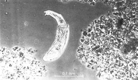 Figur 13: Foto av nematode, og til høyre av et hjuldyr (Rotifer) i ledningsslam. Foto: Harry Efraimsen, NIVA. Figur 13 viser fotografier av nematode og hjuldyr funnet i norsk ledningsslam.
