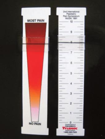 185 186 187 188 189 2.1.7 CAS (Colour Analogue Scale) CAS (Colour Analogue Scale) baserer seg på selvrapportering og er velegnet for barn fra 5-årsalderen ved akutt, postoperativ og prosedyrerelatert smerte.