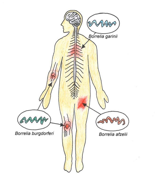 2 Borrelia garinii som ofte etablerer seg i nervesystemet. De forskjellige undergruppene av Borrelia kan infisere mer enn en type vev. Både B. afzelii og B. burgdorferi kan f.eks.