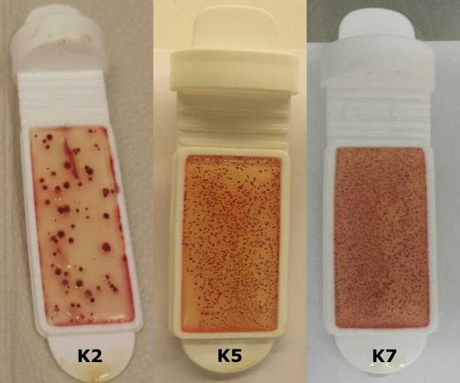 3 RESULTATER OG DISKUSJON Figur 3.4: Utvikling av mikrobiell vekst pa overflaten av kjølte makrellfileter (K) fra prøveuttak dag 2 (K2), dag 5 (K5) og dag 7 (K7).