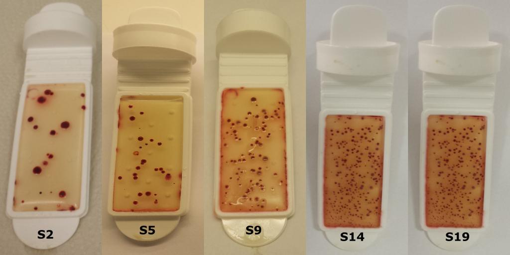5: Utvikling av mikrobiell vekst pa overflaten av de superkjølte (S) makrellfiletene gjennom lagringsperioden, fra dag 2 (S2) til dag 19 (S19).
