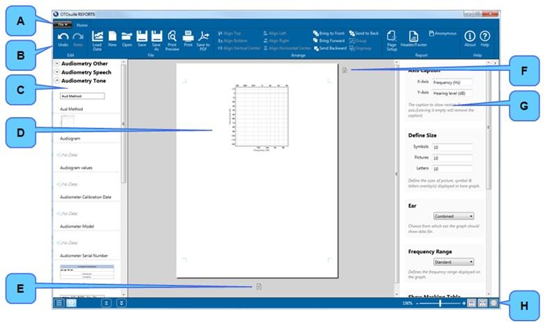 3.3 Avinstallere OTOsuite REPORTS 1. Hvis OTOsuite REPORTS er aktiv, avslutter du OTOsuite REPORTS. 2. Bruke Windows-funksjonalitet til å avinstallere programmer.