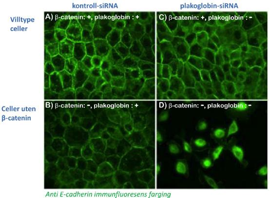 Figur 3 En forandret lokalisering av E-cadherin fra membran til cytoplasma i BxPC-3-PA-celler som mangler både β-catenin og plakoglobin kom opprundede celler, som ikke dannet normale kontakter med