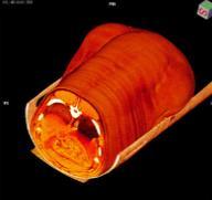 carcass quality CT & LMS scanning for carcass value