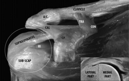 Skann hele biceps på tvers og på langs, husk lateral normal åre Følg biceps intraartikulært- også m arm på