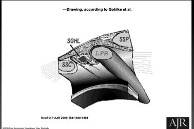 transversum bicipiti (+ lig coracoacromiale oppå) + a o t fester supraspinatus delvis