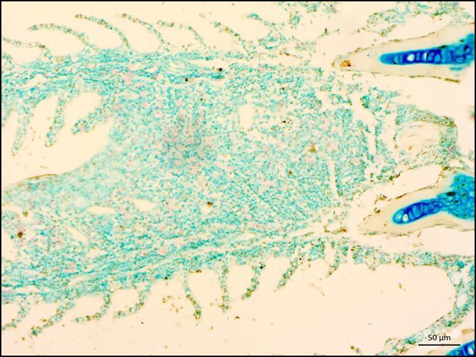 Apoptosis