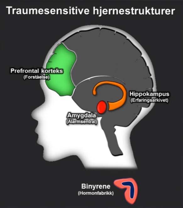 Figur 2 Traumesensitive hjernestrukturer, 2015 Midt inne i hodet, over hjernestammen ser en amygdala som er hjernens alarmsentral, her fanges opp potensielle trusler i våre omgivelser.