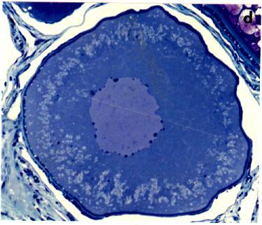 Perinucleolus-stadier