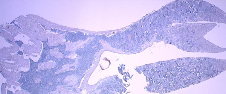 SPERMATOGENESE I TORSK I torsk skjer