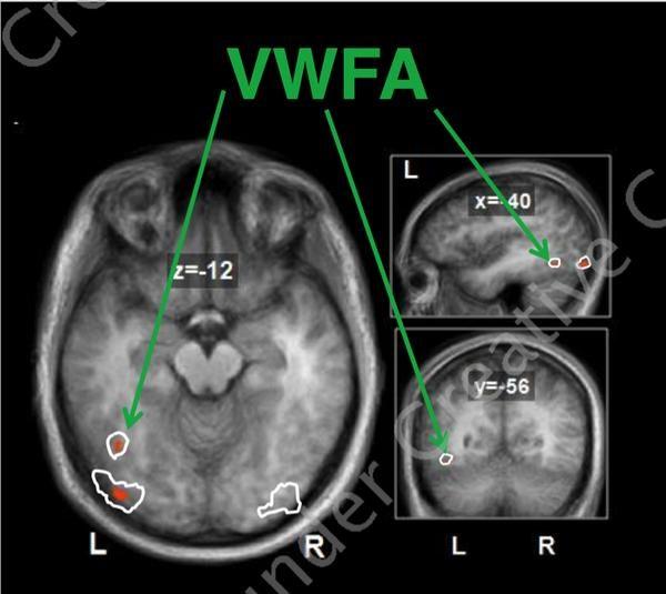 Visual word form