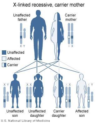Arvegang Kjønnsbunden arv gjelder arveegenskaper som er lokalisert på X-kromosomet. Gutter har bare ett X-kromosom (arvet fra mor) og vil som regel få sykdommen i mest uttalt grad.