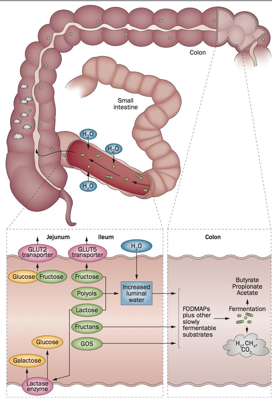 Hva er det med FODMAP i tarmen?