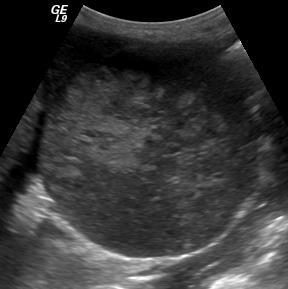 subcapsular feeding arteries.