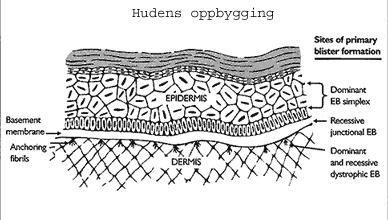 Skjematisk tverrsnitt av huden: Hudens oppbygging Områder for blemmeutvikling: Basal membran Anker fiber EB Simplex Junksjonal EB Dystrofisk EB Kilde: Dystrophic Epidermolysis Bullosa Research