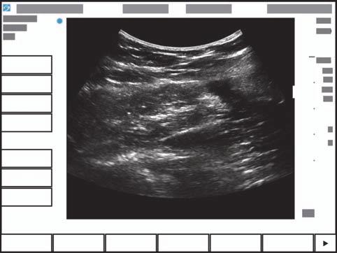 Skjermoppsett SonoSite SII-systemets skjermoppsett og kontrollene som vises der, endres i henhold til avbildningsmodus eller den aktuelle oppgaven du utfører, for eksempel måling eller innlegging av