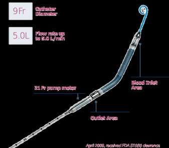 Impella