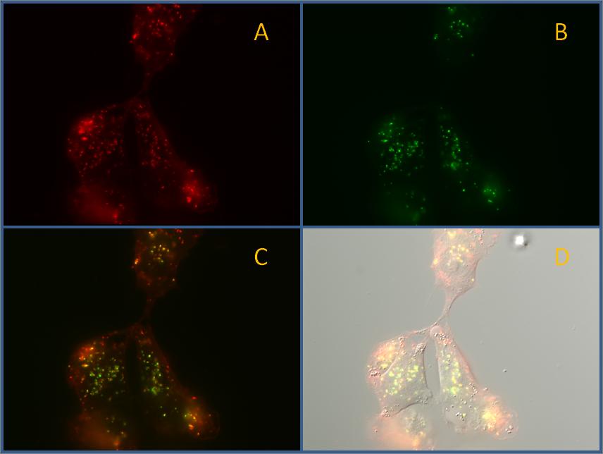 3 RESULTATER Resultatene fra uorescensmikroskopering med TPCS 2a er vist i gur 21. Granulær, intracellulær uorescens fra TPCS 2a ble observert i begge cellelinjer.