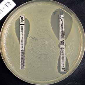 Forskjell i sonestørrelse > 5 mm mellom cefalosporinet, og cefalosporinet i kombinasjon med klavulansyre, indikerer positiv test. Figur 7. NDM1 ( ) positiv E.