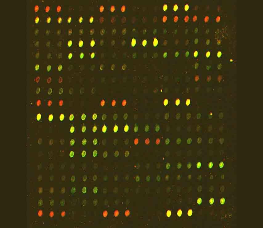 14 2. Mikroarrayer Figur 2.4: Bilde av en scannet mikroarray. Rød farge tilsvarer oppregulert gen i syk prøve, mens grønn farge tilsvarer nedregulert gen i syk prøve.