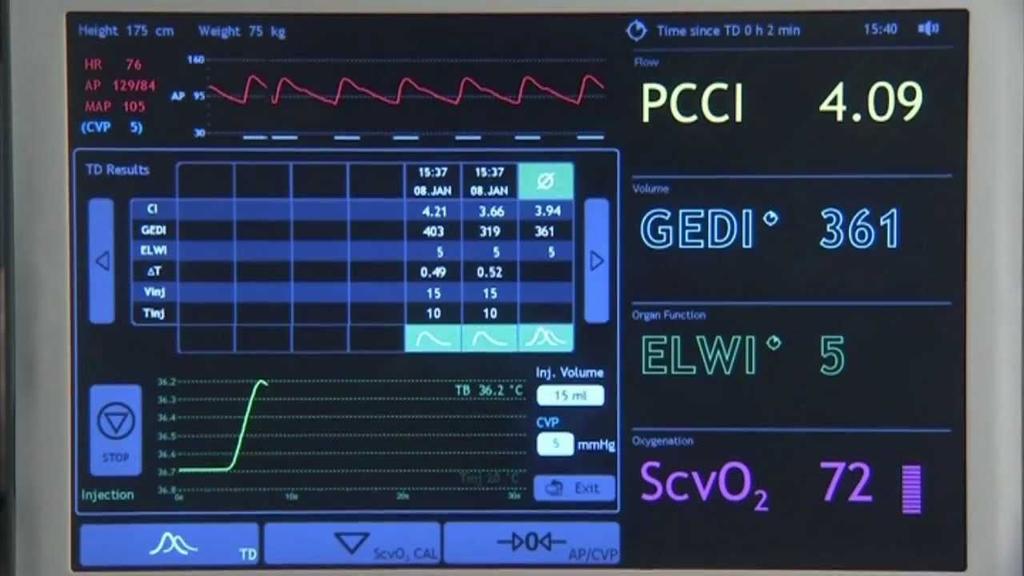 PiCCO -Pulse contour