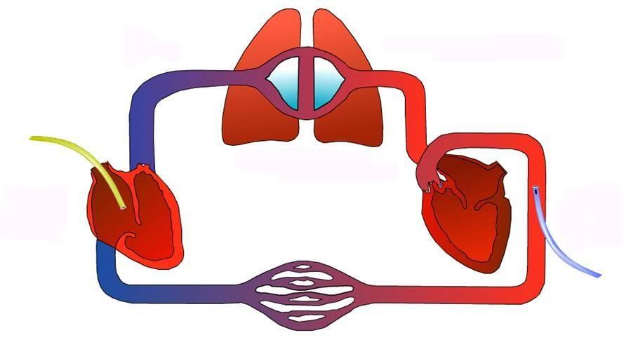 a. Transpulmonary Thermodilution statisk måling CVC Bolus