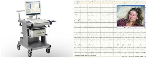 Utredning av epilepsisuspekte anfall Ved utredning av epilepsi tas som regel standard EEG og deretter