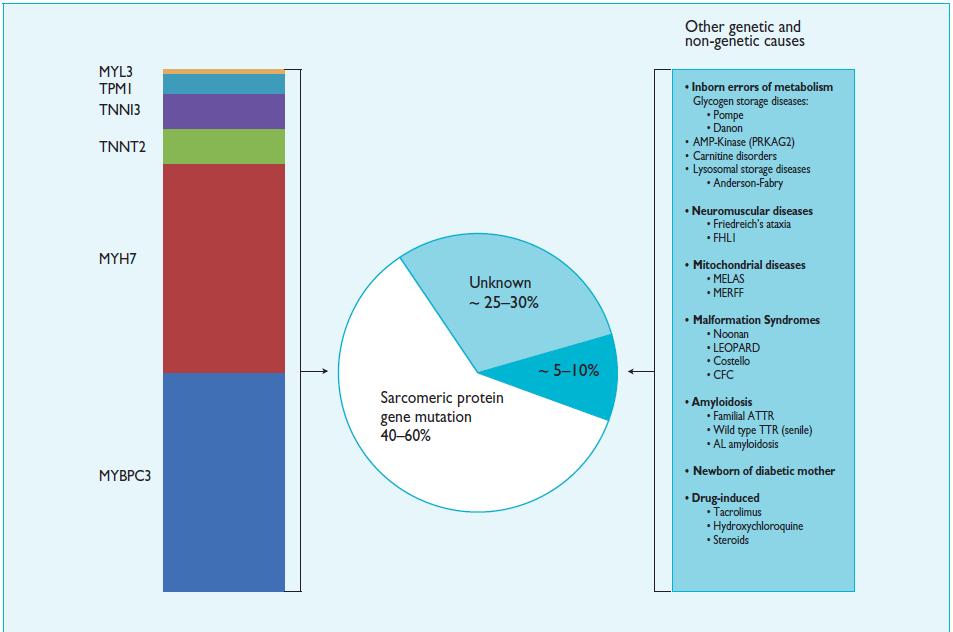 Ulike årsaker til HCM Abnormal loadingconditions: -Aortastenose -Hypertensjon -Idrettshjerte -Sigmoid septum Hvis genotype