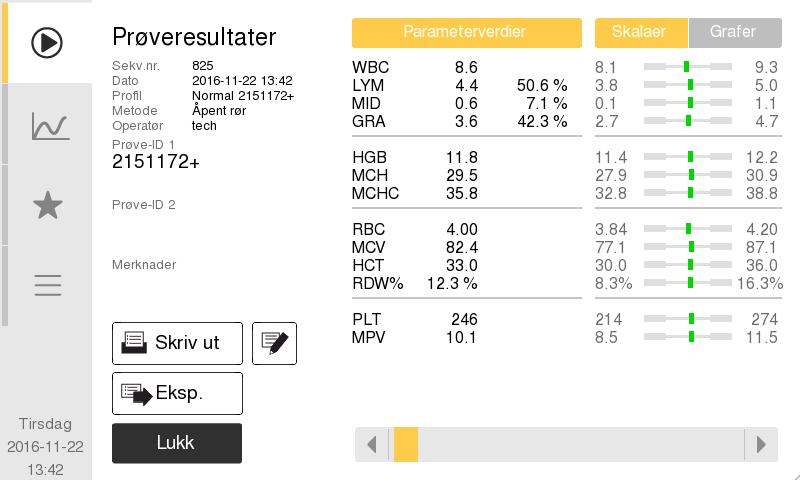 z Hvis kontrollresultatene er godkjent, gjentar du stegene ovenfor med neste kontrollnivå. z Hvis kontrollresultatene ikke er godkjent, gjentar du stegene ovenfor med samme kontrollnivå.