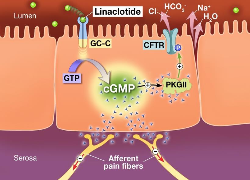 Linaclotide IBS-C Chey et