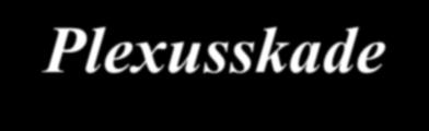 Plexusskade (Rt. 2010 s.