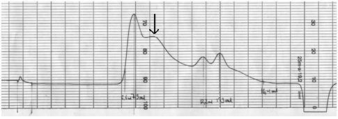 86 Figur 6.6 Kromatogram over molekylvekstdistribusjon til TM50WS1GalI. Pilen viser hvor hovedtoppen kommer ut.