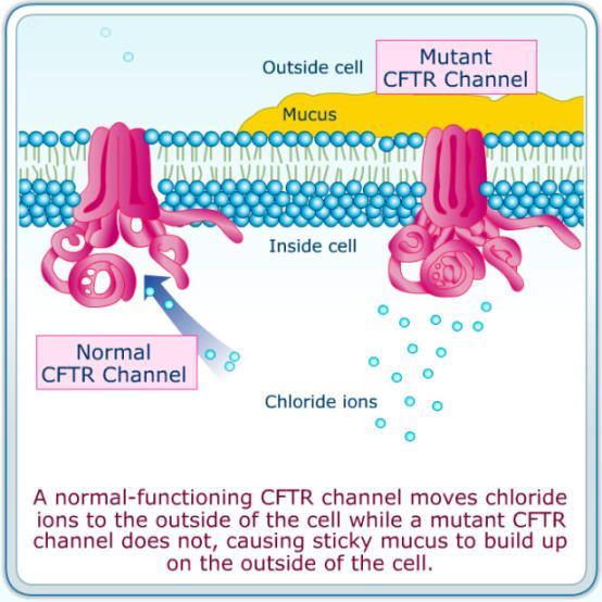 Tilstander Utvidet Nyfødtscreening Andre tilstander Cystisk fibrose (CF) Sykdommen skyldes mutasjoner i CFTR (Cystic Fibrosis Transmembrane Conductance Regulator) - genet på kromosom 7, som koder for