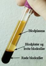 2.2.1). Blodplasma er den gulaktige øverste fasen etter sentrifugering, den består av omlag 92% vann, 7% lipoproteiner og 1% organiske og uorganiske vannløselige substanser.