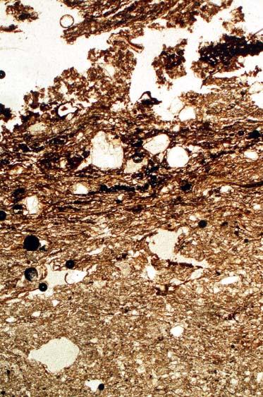 sediments (Layer 2)(see Fig 34), which include a layer of byre waste fragments.