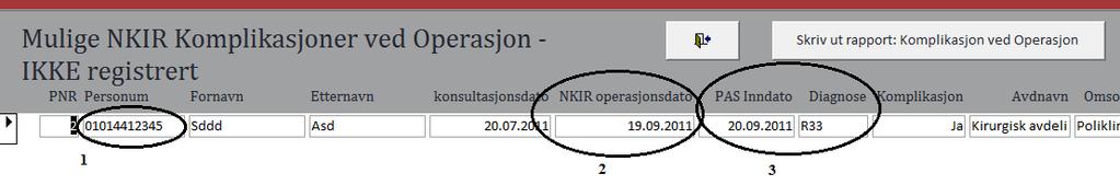 3.4. Sykehus som deltar i valideringen Fem sykehus har deltatt i valideringen av komplikasjoner i 2017: Vestre Viken HF, Bærum sykehus Oslo universitetssykehus HF, Ullevål sykehus Sykehuset i