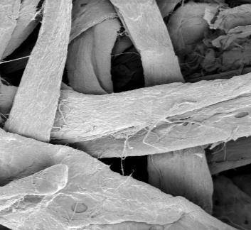 diameter 75µm ( 20 200 µm) Typical length 2 50 cm (20 000 500 000 µm) Cellulose fiber in