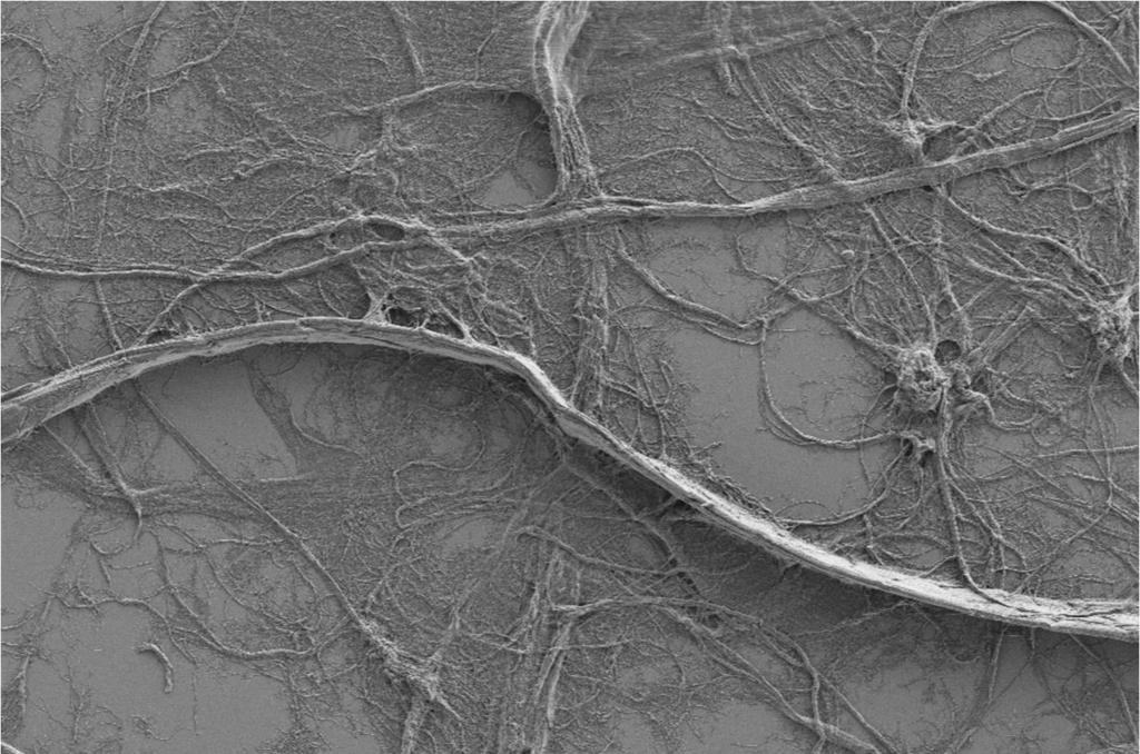 cellulose (MFC) MFC Typical diameter 10 100 nm (0,01 0,1 µm) Typisk diameter 10 100 nm (0,01