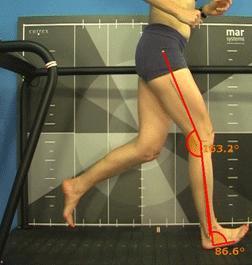 dynamisk valgus (Rudolph et al., 2001; Risberg et al., 2008; Ernst et al.