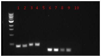 Resultater Figur 3.1, 3.2 og 3.3 viser resultatet fra PCR med en generell primer (341F og 806R) kjørt på 1 % agarose gel. Resultatet viser at Figur 3.