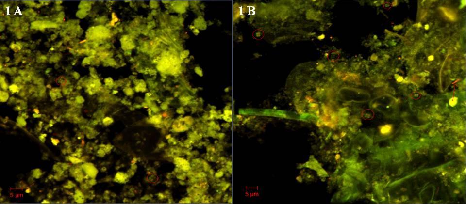 Resultater 20CM/30FE: observasjon av kokker og diplokokker, store mengder bakgrunnsstøy og autofluorescens (1A). Enkelte observasjoner av Methanosarcina i uke 4(1B). Figur 3.25.