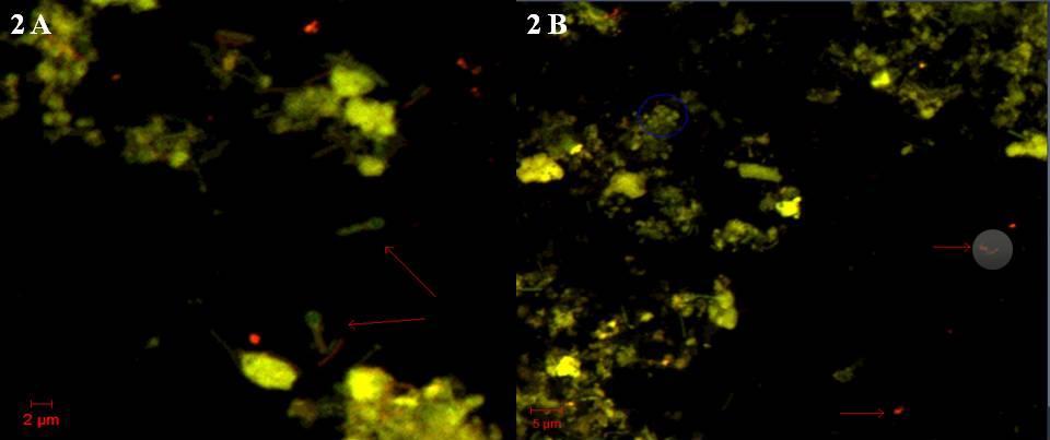 Forekomst av Methanosarcinales fra uke 4. 30CM/20FE: observasjon av stavbakterier (enkle, eller to og to sammen), kokker og diplokokker (2B).