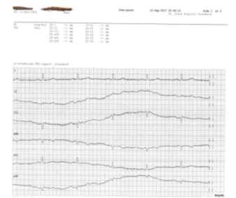 5.3.2 Visning Avsender Fastlege Rita Lin Kattskinnet legesenter Pasient Line Danser FNR: 131169 00216 Mottaker ST OLAVS HOSPITAL HF - Ortopedisk kirurgi Helsefaglig dialog Type Tema Innhold