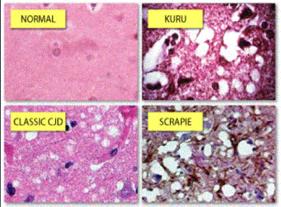 PRIONSYKDOM Hjortevilt Sau Storfe Mennesket Papa Guinea) CWD Scrapie (1700-tallet- kjøttbeinben fôring storfe) Kugalskap/Bovine Spongiforme Encephalopathie Creutzfeldt-Jackob Syndrom /Kuru