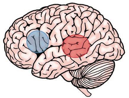 Ulike typer afasi Afasi skyldes vanligvis en skade i venstre hjernehalvdel. Språkvanskene kan arte seg på ulike måter. Det kommer an på hvor stor skaden i hjernen er.