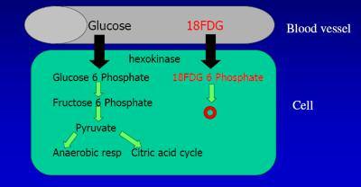 Figur 2. Transport av glukose og 18 F-FDG fra blodbanen og intra - cellulært. bolsk aktivitet i svulster, betennelser og noen andre typer vev og prosesser.