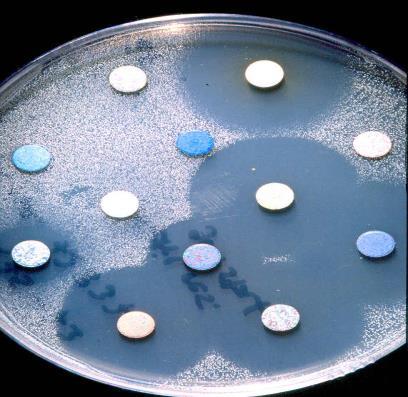 Kasuistikk (2) Svar dyrkningsprøve: Staphylococcus aureus Penicillin - Resistent (R) Oxacillin - R Erytro, klora,